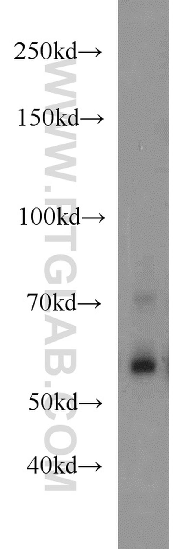 RBPJ Antibody in Western Blot (WB)