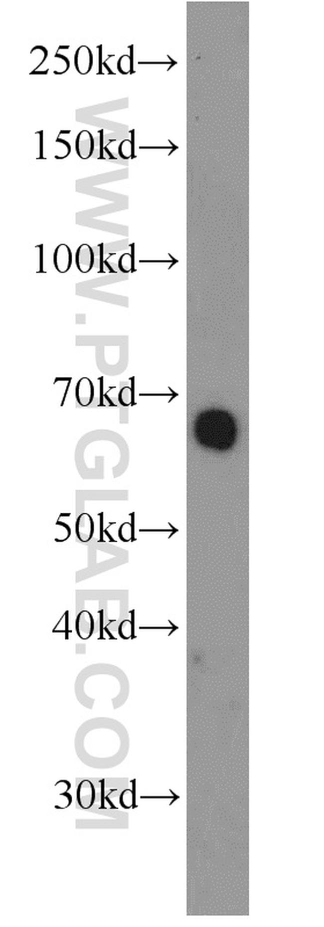 RBPJ Antibody in Western Blot (WB)