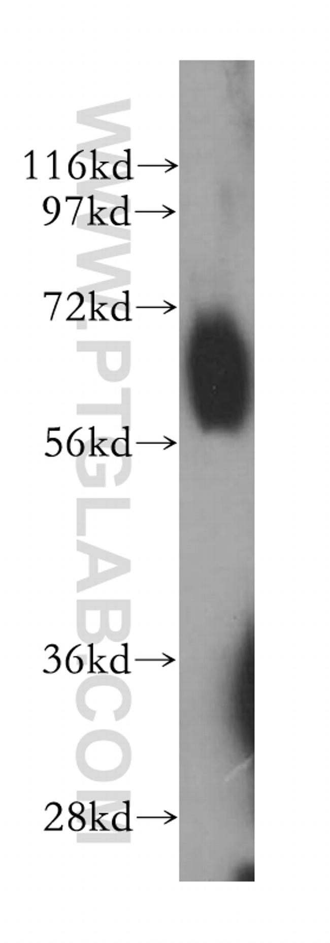 RBPJ Antibody in Western Blot (WB)