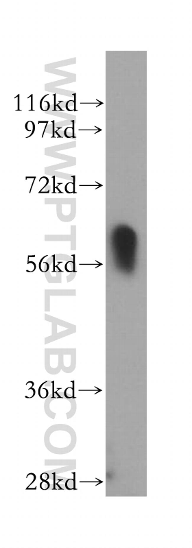 RBPJ Antibody in Western Blot (WB)