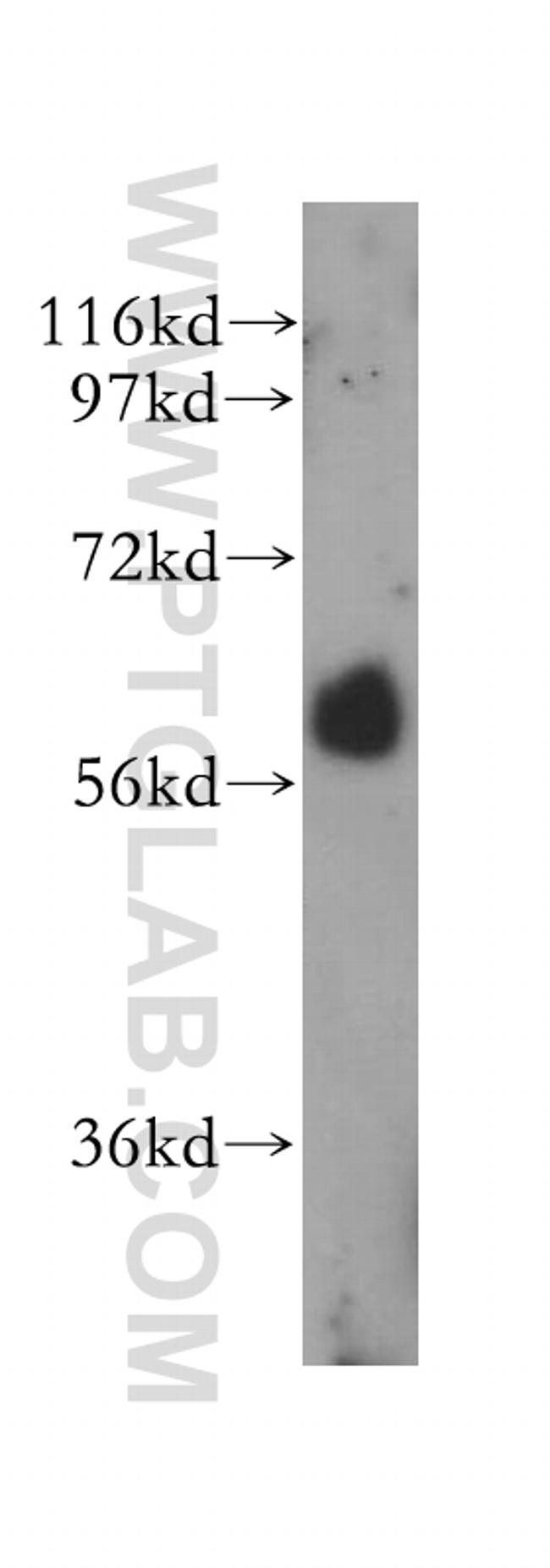 RBPJ Antibody in Western Blot (WB)