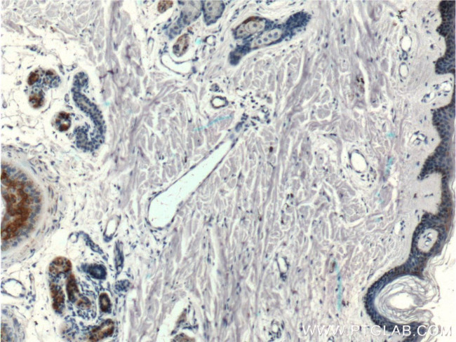 ST3GAL5 Antibody in Immunohistochemistry (Paraffin) (IHC (P))