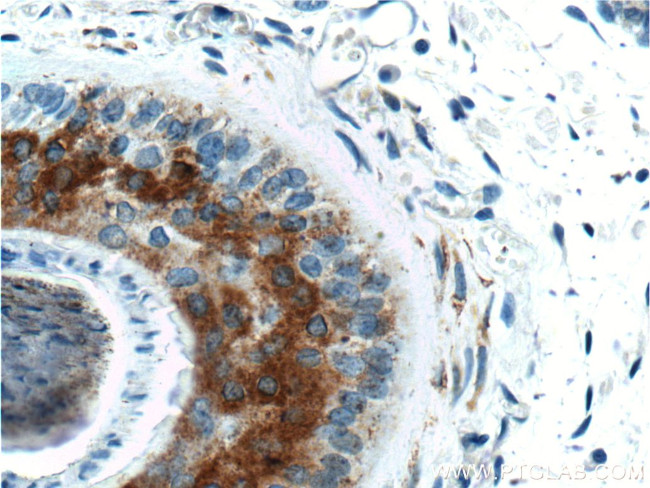 ST3GAL5 Antibody in Immunohistochemistry (Paraffin) (IHC (P))