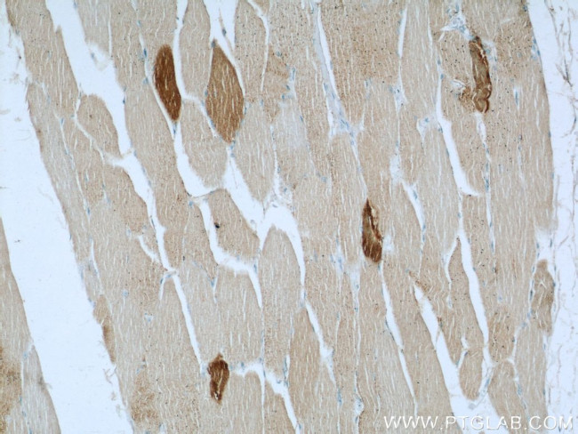 ST3GAL5 Antibody in Immunohistochemistry (Paraffin) (IHC (P))