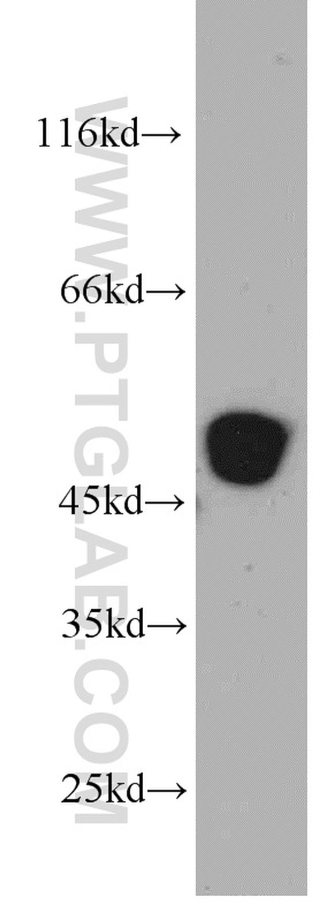 ST3GAL5 Antibody in Western Blot (WB)