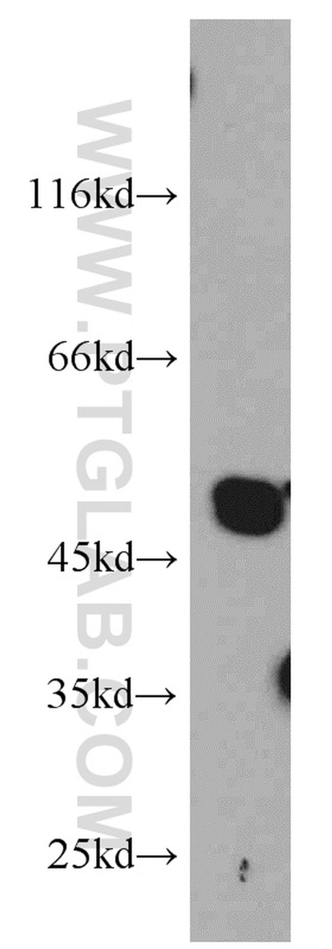 ST3GAL5 Antibody in Western Blot (WB)