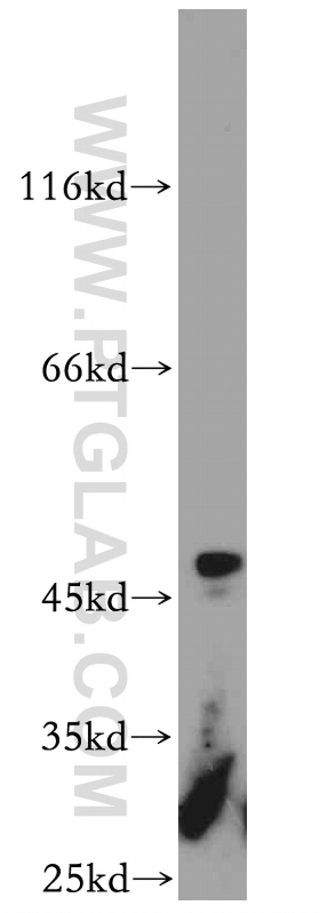 ST3GAL5 Antibody in Western Blot (WB)