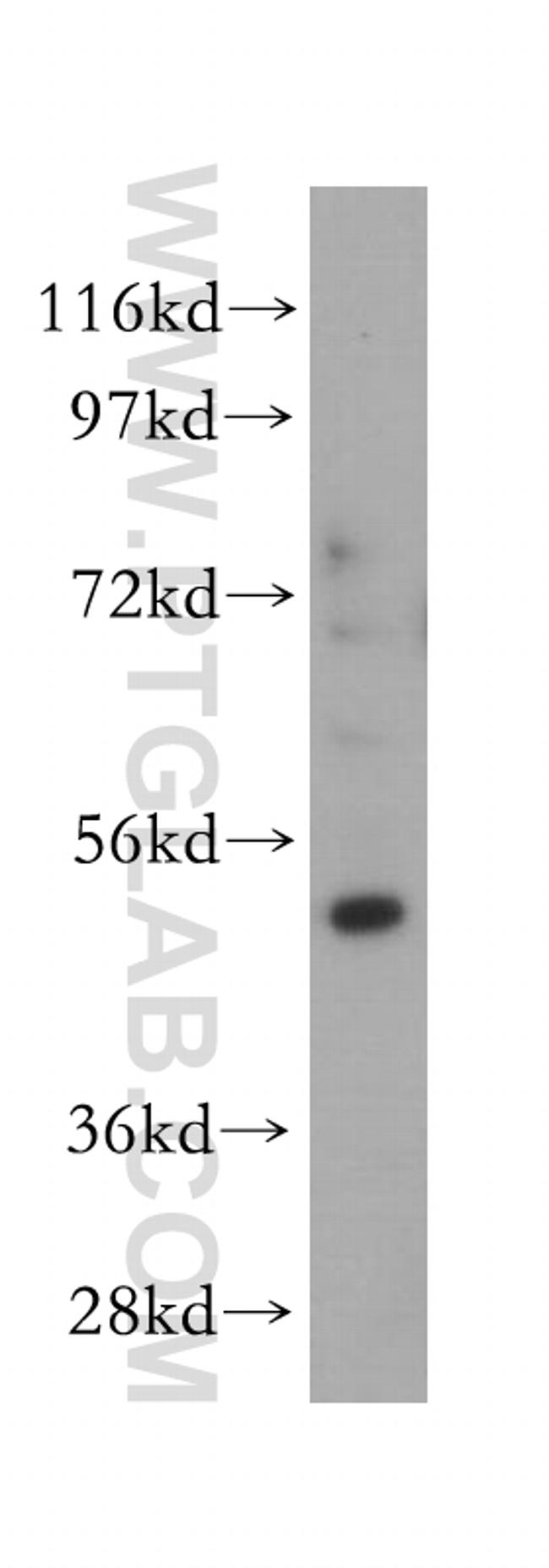 ST3GAL5 Antibody in Western Blot (WB)