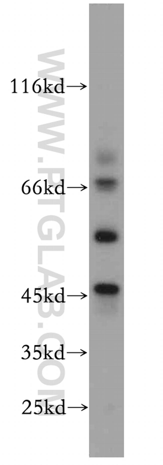 ST3GAL5 Antibody in Western Blot (WB)