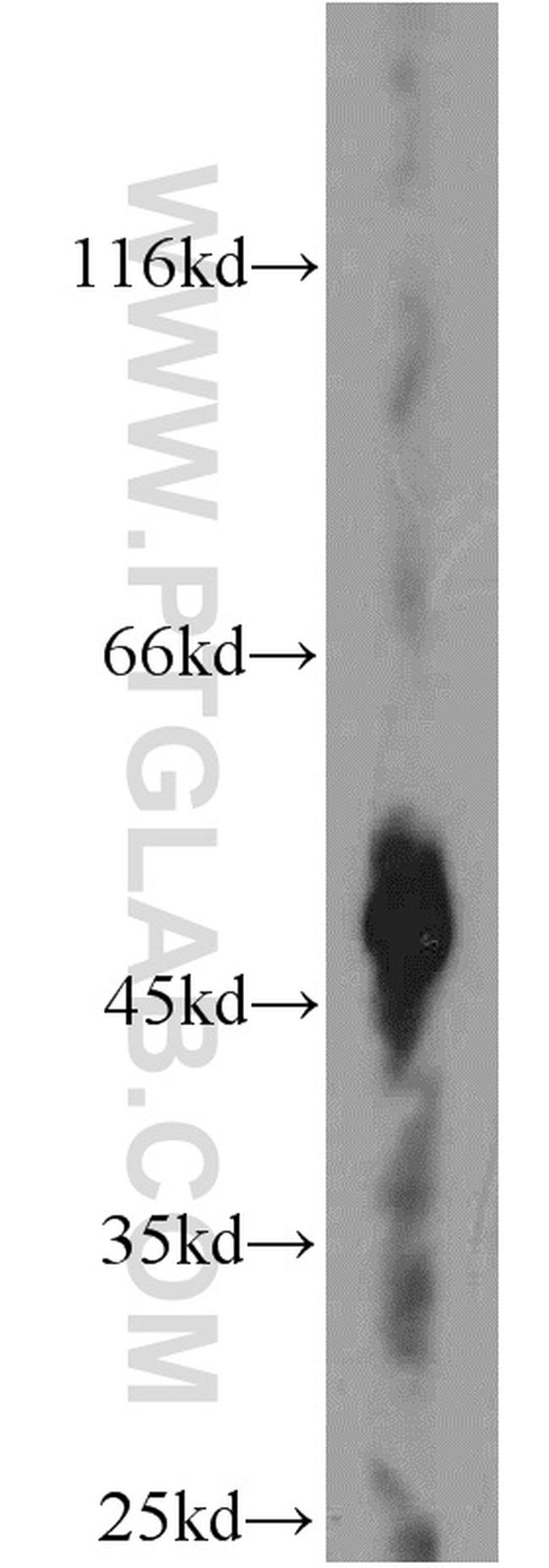 ST3GAL5 Antibody in Western Blot (WB)