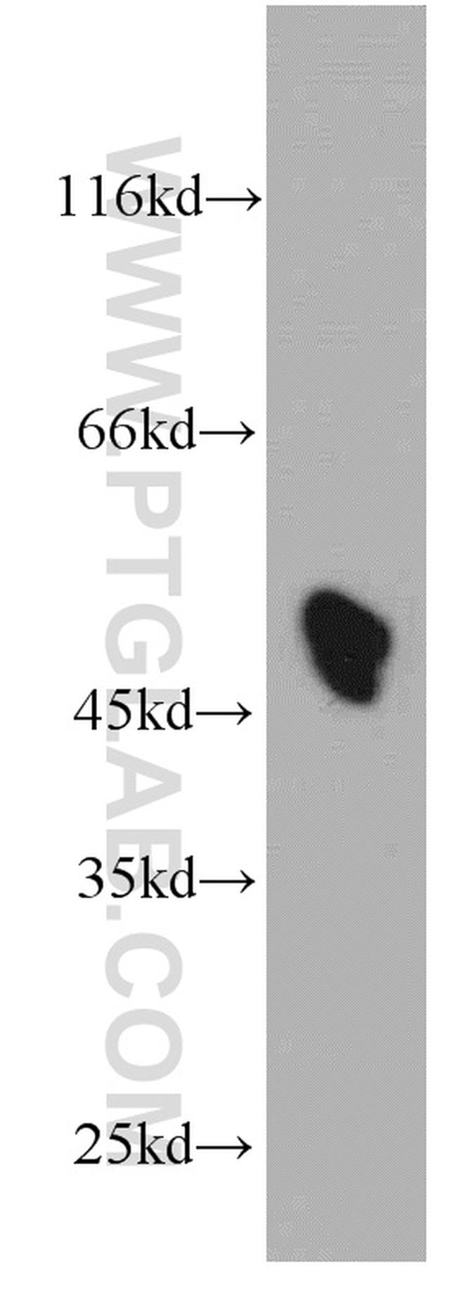 ST3GAL5 Antibody in Western Blot (WB)