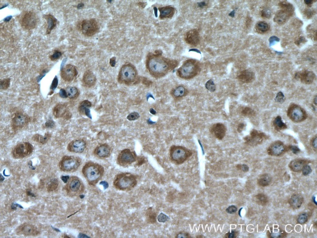 KIF17 Antibody in Immunohistochemistry (Paraffin) (IHC (P))