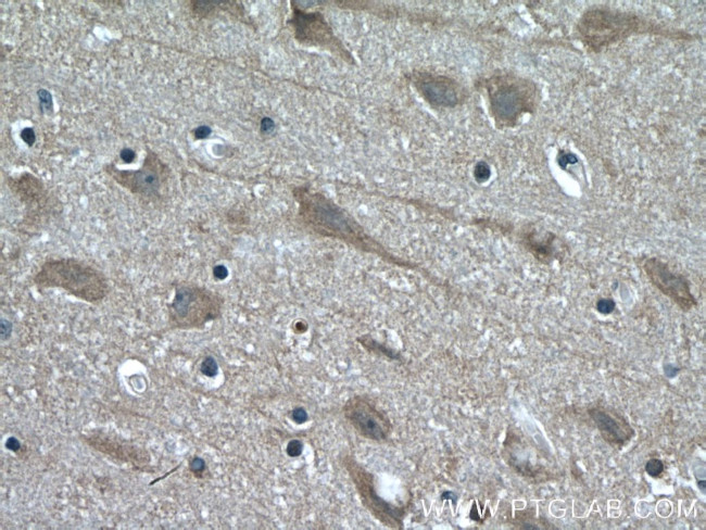 KIF17 Antibody in Immunohistochemistry (Paraffin) (IHC (P))