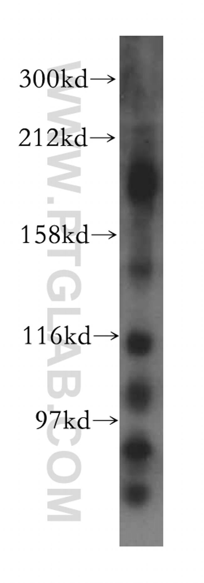 KIF17 Antibody in Western Blot (WB)