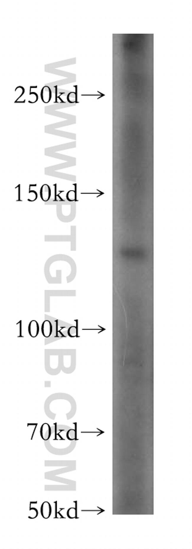 ADCY6 Antibody in Western Blot (WB)