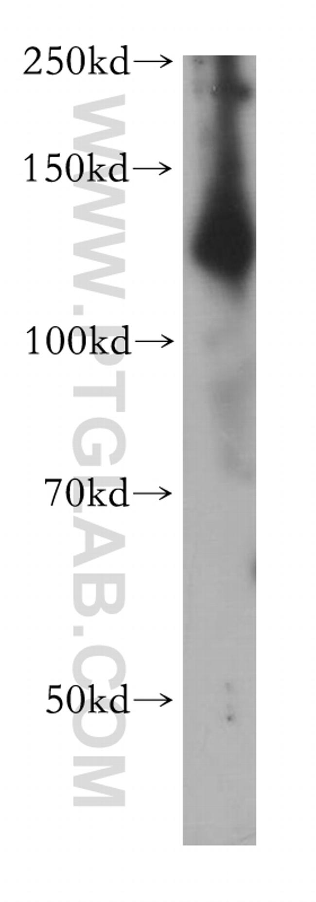 ADCY6 Antibody in Western Blot (WB)