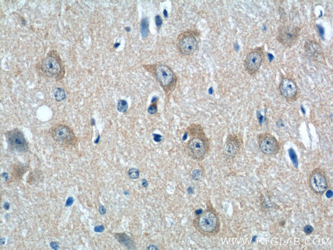 NMUR1 Antibody in Immunohistochemistry (Paraffin) (IHC (P))