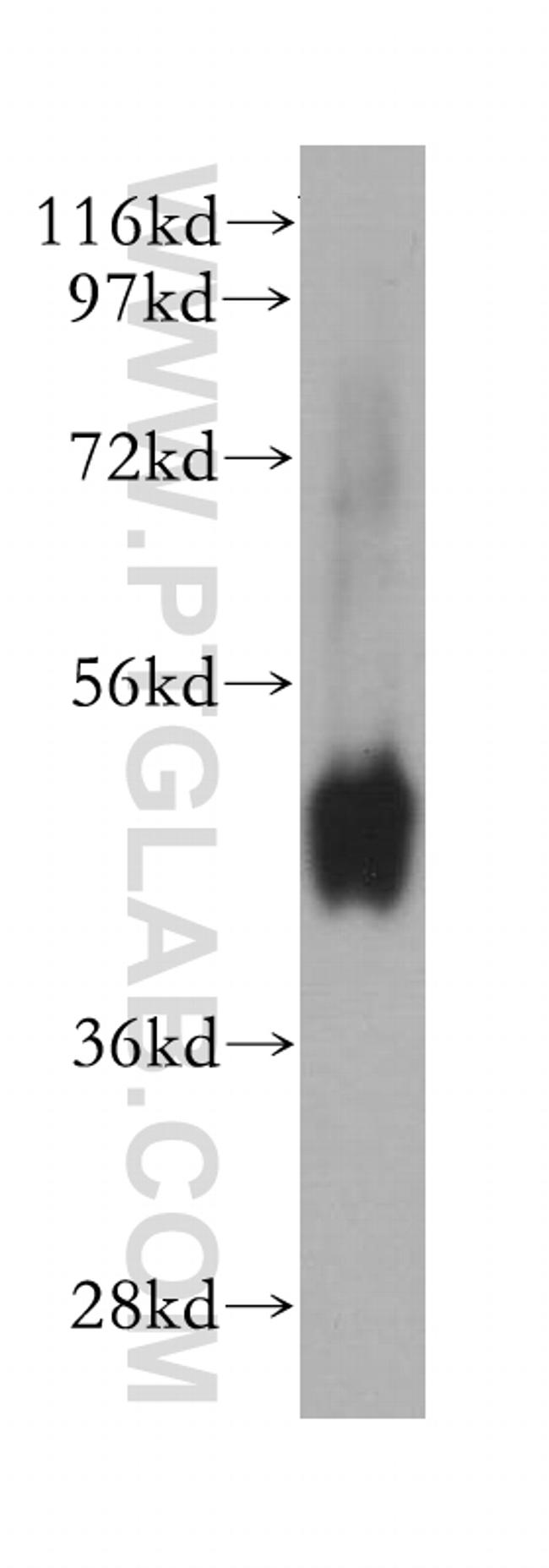 NMUR1 Antibody in Western Blot (WB)