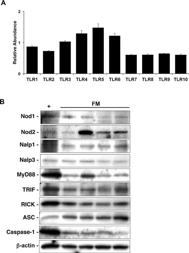 MyD88 Antibody in Western Blot (WB)