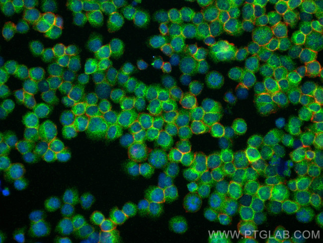 SHARPIN Antibody in Immunocytochemistry (ICC/IF)