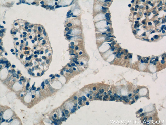 SHARPIN Antibody in Immunohistochemistry (Paraffin) (IHC (P))