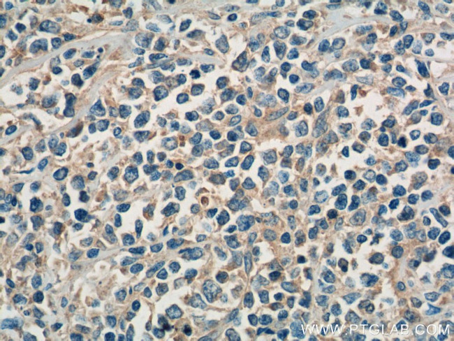 SHARPIN Antibody in Immunohistochemistry (Paraffin) (IHC (P))