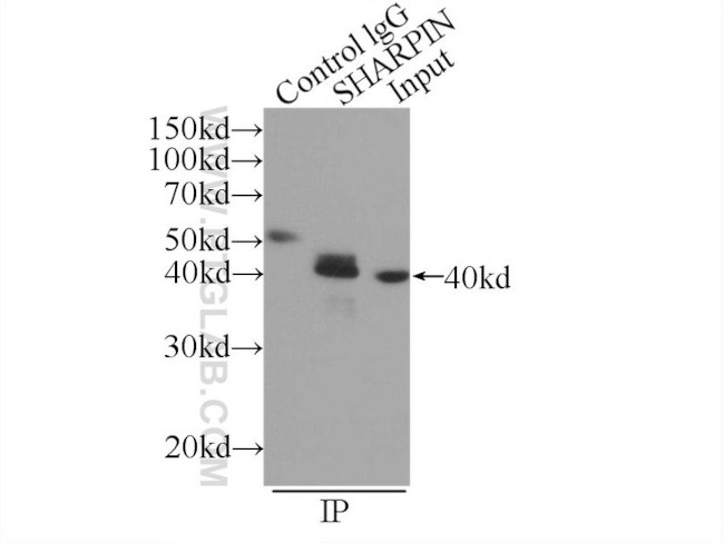 SHARPIN Antibody in Immunoprecipitation (IP)