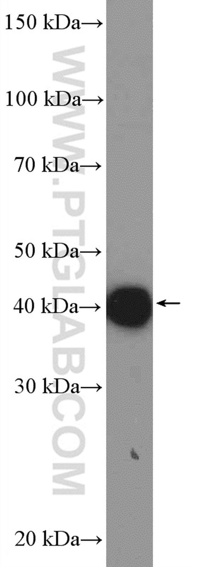 SHARPIN Antibody in Western Blot (WB)