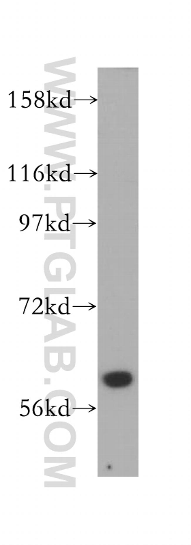 ABCB10 Antibody in Western Blot (WB)