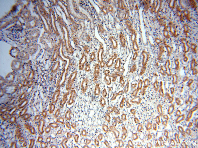 AFG3L2 Antibody in Immunohistochemistry (Paraffin) (IHC (P))