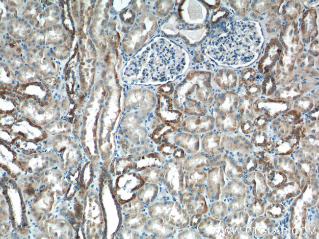 AFG3L2 Antibody in Immunohistochemistry (Paraffin) (IHC (P))