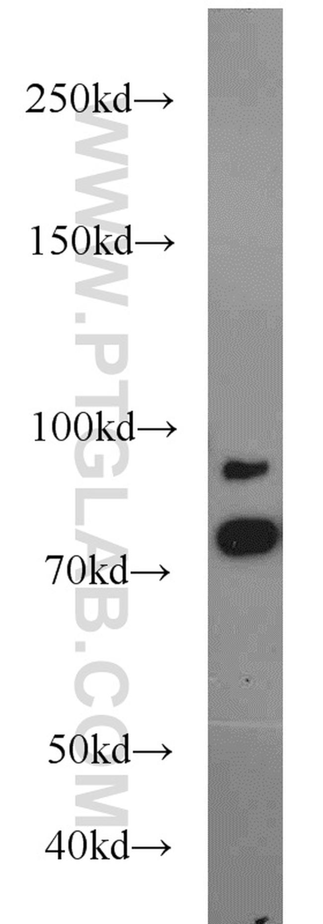 AFG3L2 Antibody in Western Blot (WB)