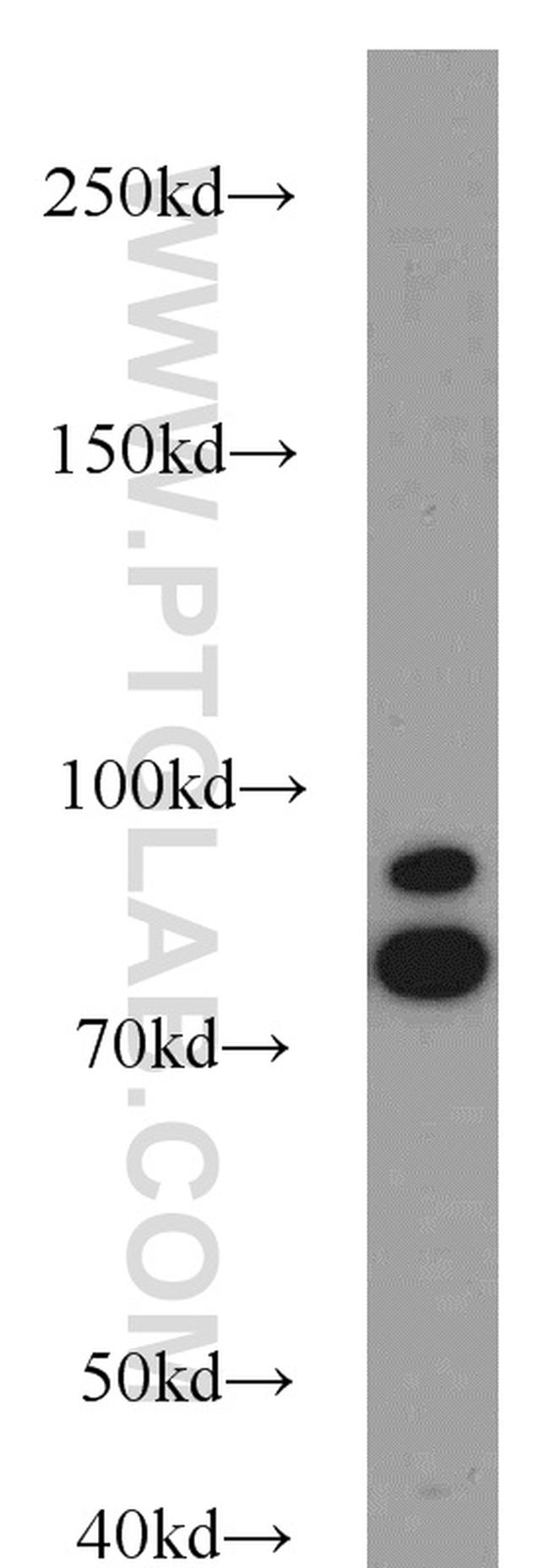 AFG3L2 Antibody in Western Blot (WB)