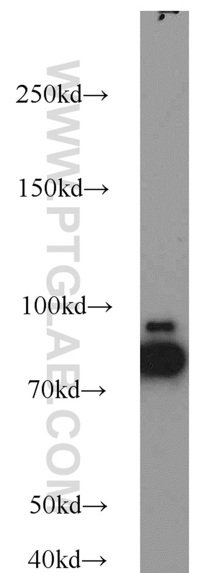 AFG3L2 Antibody in Western Blot (WB)