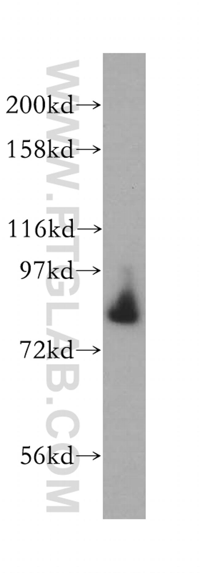 AFG3L2 Antibody in Western Blot (WB)