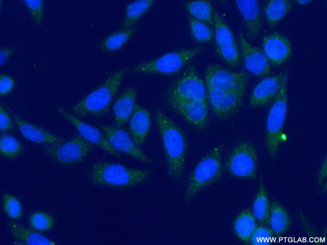 DDX6 Antibody in Immunocytochemistry (ICC/IF)