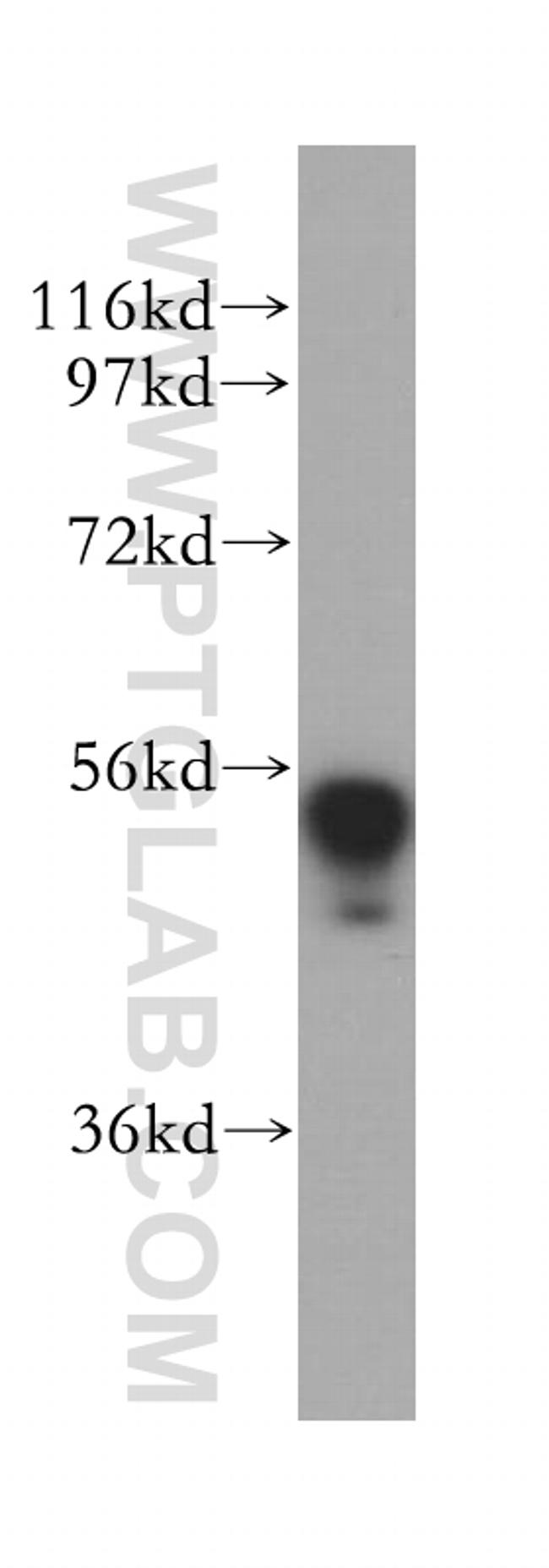 DDX6 Antibody in Western Blot (WB)