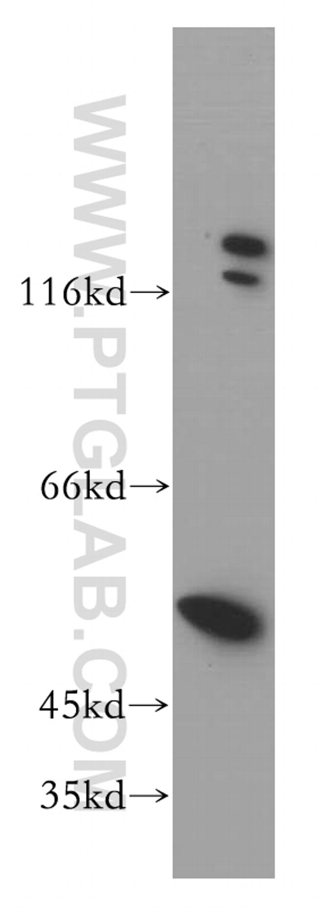 DDX6 Antibody in Western Blot (WB)