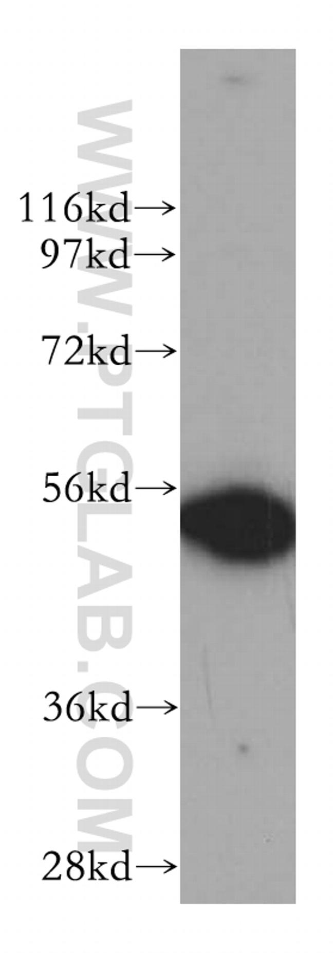 DDX6 Antibody in Western Blot (WB)