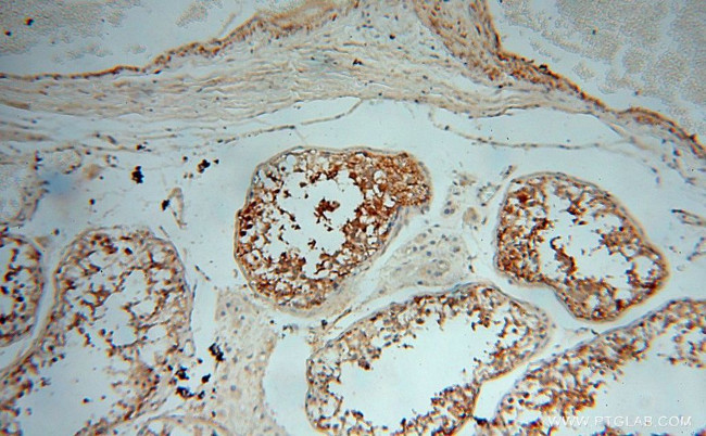 PPP1R15B Antibody in Immunohistochemistry (Paraffin) (IHC (P))