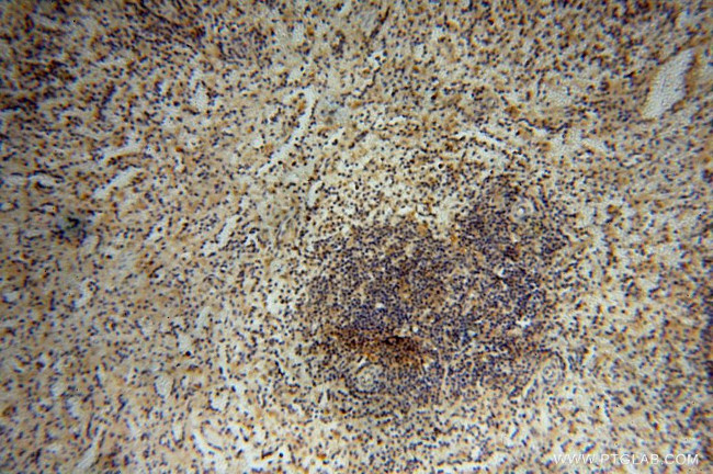 PPP1R15B Antibody in Immunohistochemistry (Paraffin) (IHC (P))