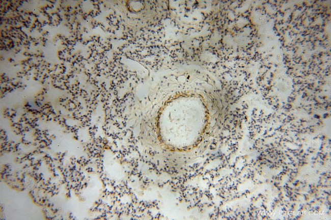 PPP1R15B Antibody in Immunohistochemistry (Paraffin) (IHC (P))