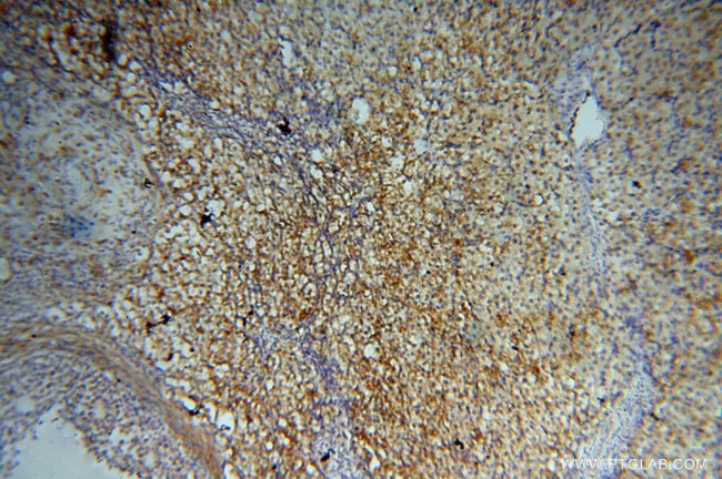 PPP1R15B Antibody in Immunohistochemistry (Paraffin) (IHC (P))