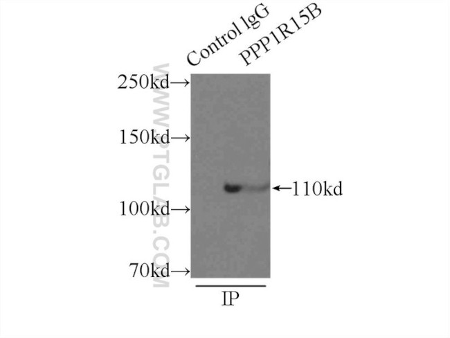 PPP1R15B Antibody in Immunoprecipitation (IP)