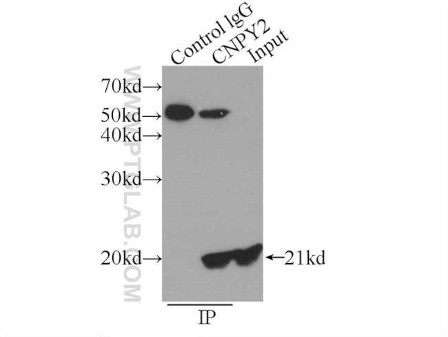 CNPY2/MSAP Antibody in Immunoprecipitation (IP)