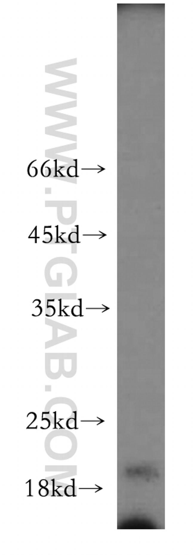 CNPY2/MSAP Antibody in Western Blot (WB)