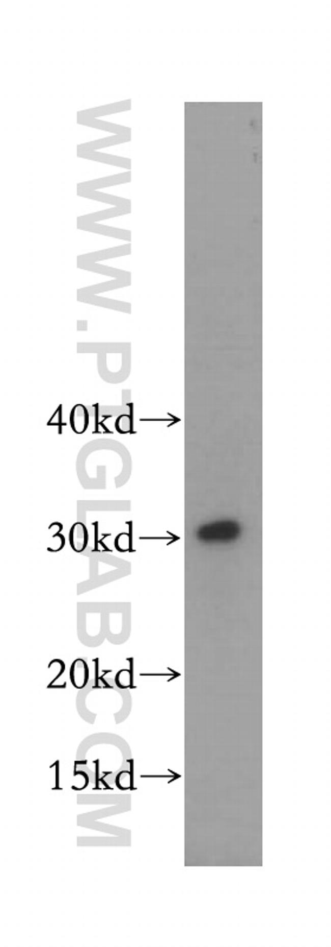 SRPRB Antibody in Western Blot (WB)