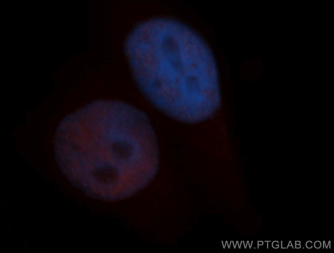 SIN3A Antibody in Immunocytochemistry (ICC/IF)