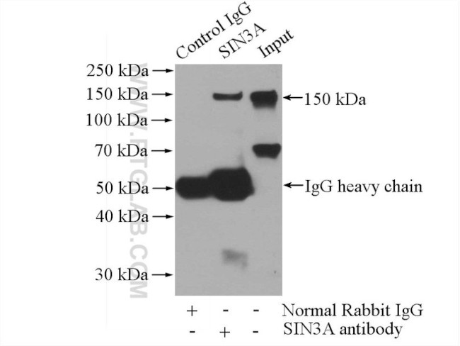 SIN3A Antibody in Immunoprecipitation (IP)