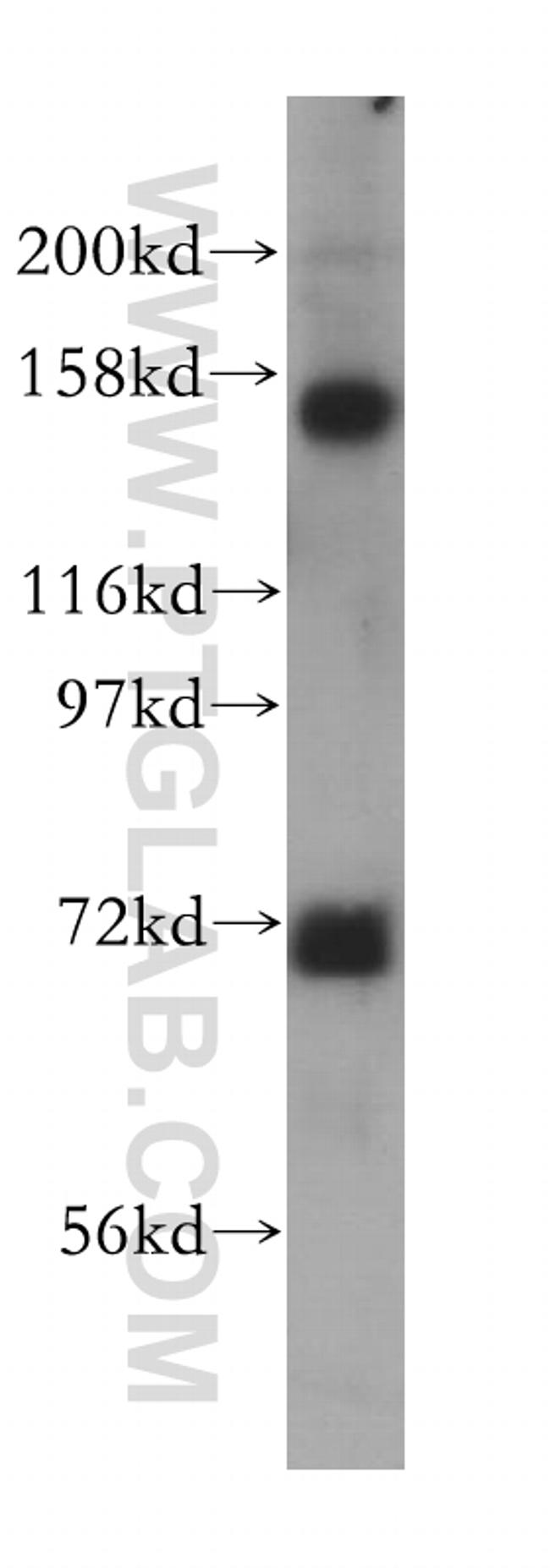 SIN3A Antibody in Western Blot (WB)